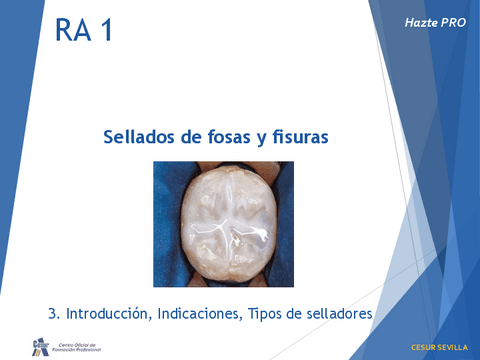 Sellado-fosas-y-fisuras.pdf