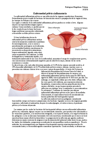 Enfermedad-pelvica-inflamatoria.pdf