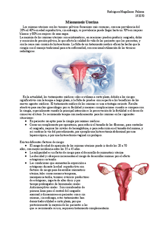 Miomatosis-Uterina.pdf