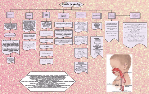 Atresia-de-esofago.pdf