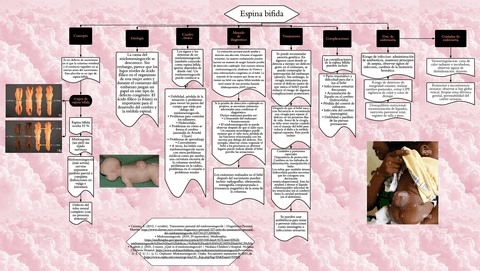 Espina-Bifida.pdf