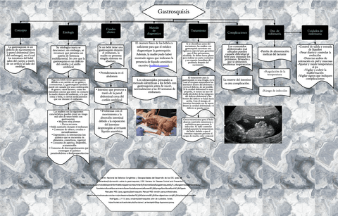 Gastrosquisis.pdf
