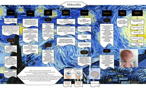 Hidrocefalia.pdf