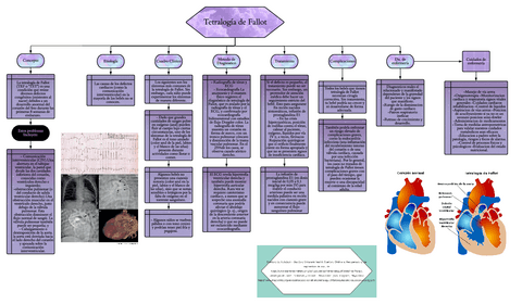 Tetralogia-de-Fallot.pdf