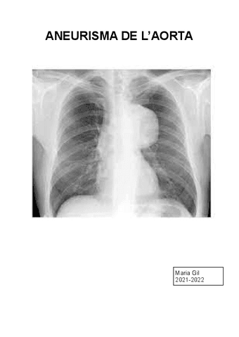 ANEURISMA-DE-LAORTA.pdf