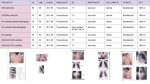projeccions-esternumcostelles.pdf