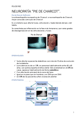 Peu-de-risc-8-Neuropatia-Pie-de-Charcot.pdf