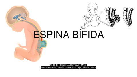 ESPINA-BIFIDA.pdf