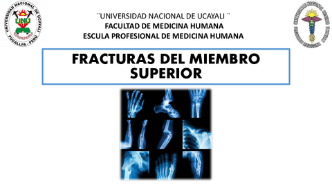 Fractura-de-miembro-superior..pdf