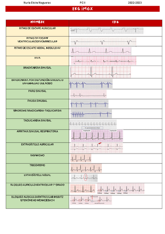 Ekg-IMGX.pdf