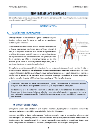 15.-Trasplante-de-organos.pdf