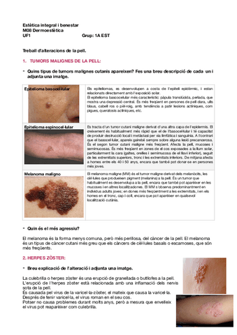 Treball-dalteracions-de-la-pell.pdf