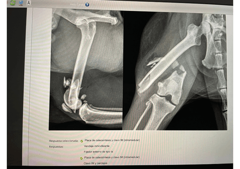 EXAMEN-CACII-RESUELTO-TRAUMA-Y-ONCO.pdf