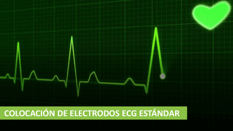 COLOCACION-DE-ELECTRODOS-ECG-ESTANDAR.pdf