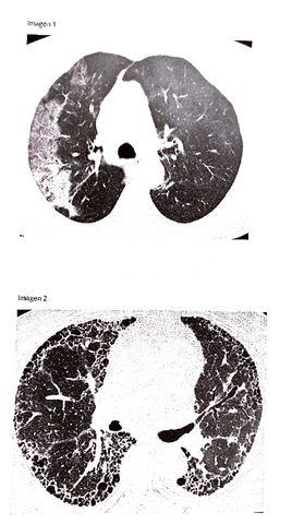 imagenes-examen-POSII-MARZO-2022-2.pdf