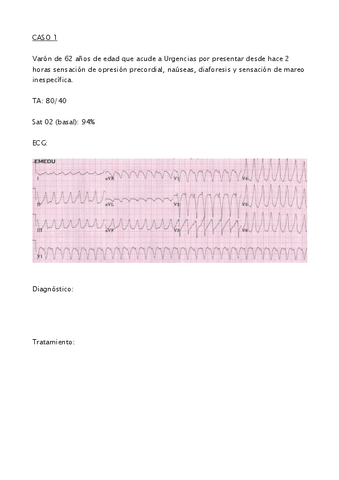 Examen-Arritmias.pdf