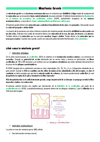 Miastenia-Gravis.pdf