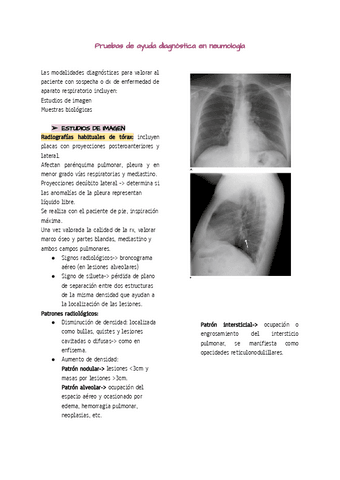 Pruebas-de-ayuda-diagnostica-en-neumologia.pdf