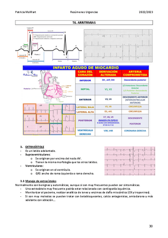 T6.-Arritmias.pdf