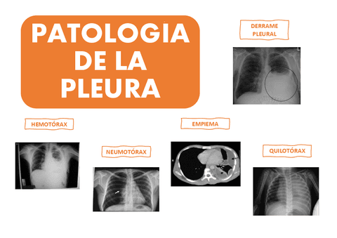 PLEURA.pdf