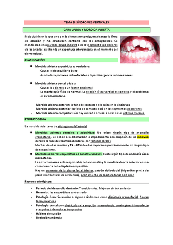 TEMA-6-SINDROMES-VERTICALES.pdf