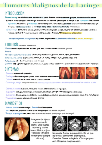 15.-Tumores-Malignos-Laringe.pdf