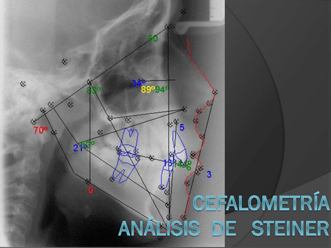 Unidad-5-Cefalometria.-Analisis-de-Steiner..pdf