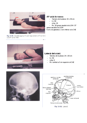 projeccions-crani-sinus-paranasals-ossos-facials.pdf
