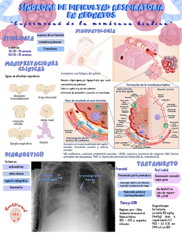 Sindrome-de-dificultad-respiratoria.pdf