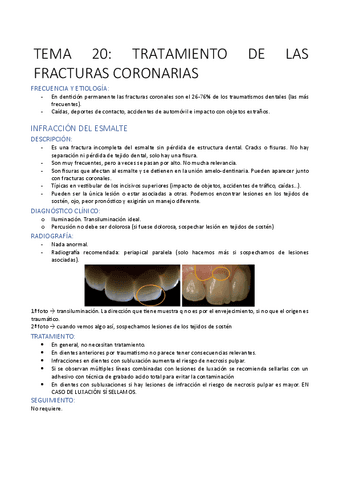 TEMA-20-PTD.pdf