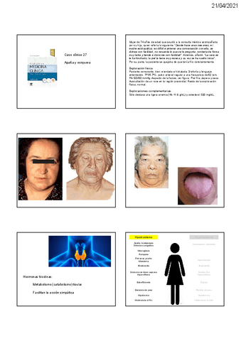 Casos-tiroides-Autoinmunidad.pdf