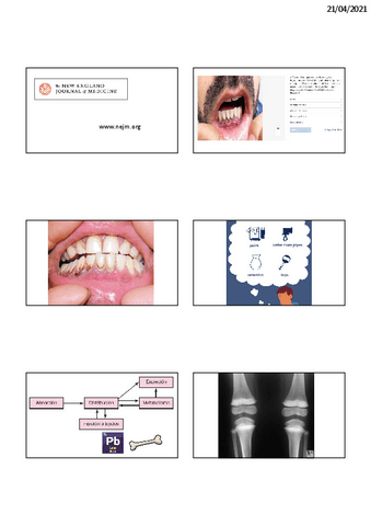 Casos-plomo-y-acetaldehido-Toxicos.pdf