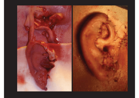 cirugia-y-traumatologia-maxilofacial-IV.pdf