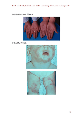02.-Dermatologia-basica-para-el-medico-general-autor-Zeas-D.-Ivan-Marcelo-Ordonez-V.-Maria-Soledad-5.pdf