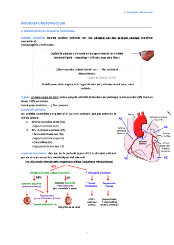 4.-Ateroesclerosi-i-malaltia-coronaria.pdf