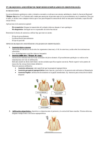T7-anestesi.pdf