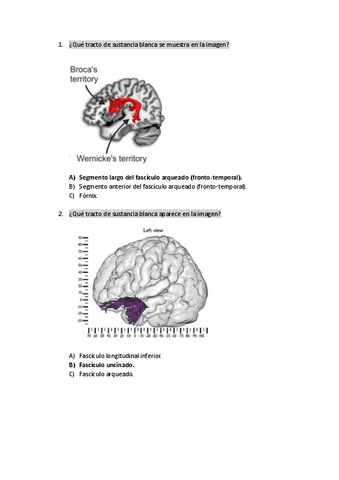 EXAMEN-BLOQUE-3-F.-PSICOBIOLOGIA-II-RESPUESTAS-CLARAS.pdf.pdf