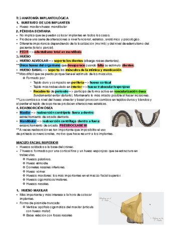 3-implantes.pdf