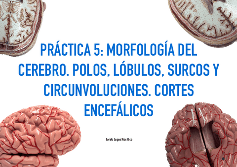 PRACTICA-5-MORFOLOGIA-DEL-CEREBRO.-POLOS-LOBULOS-SURCOS-Y-CIRCUNVOLUCIONES.-CORTES-ENCEFALICOS.pdf