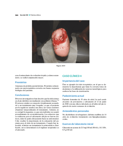 Pie-Diabetico-Atencion-Integral-S-28.pdf