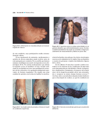 Pie-Diabetico-Atencion-Integral-S-29.pdf