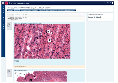 EVALUACION-CONTINUA-DIGESTIVO-I-CURSO-2020-21.pdf