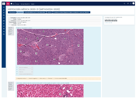 EVALUACION-CONTINUA-DIGESTIVO-III-CURSO-2020-21.pdf