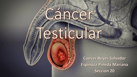 Cancer-de-testiculo.pdf