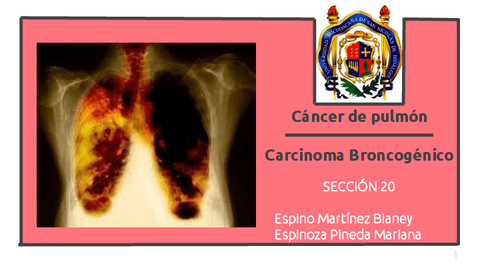 Carcinoma-Broncogenico-respiratorio.pdf