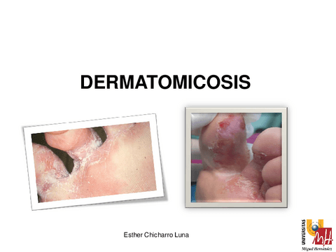 T7-Dermatomicosis-2013-14.pdf