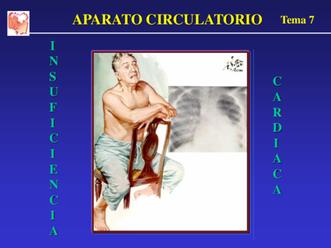 10 - Sindrome insuficiencia cardiaca.pdf