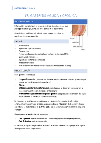 T17.-Gastritis.pdf