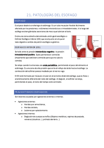 T21.-Patologias-del-esofago.pdf