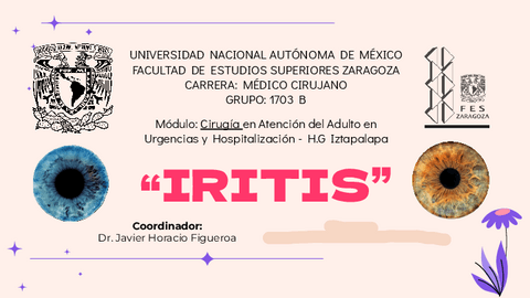 Expo.-Iritis.pdf